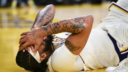 万幸！浓眉：不需要戴护目镜 已为明天比赛做好准备