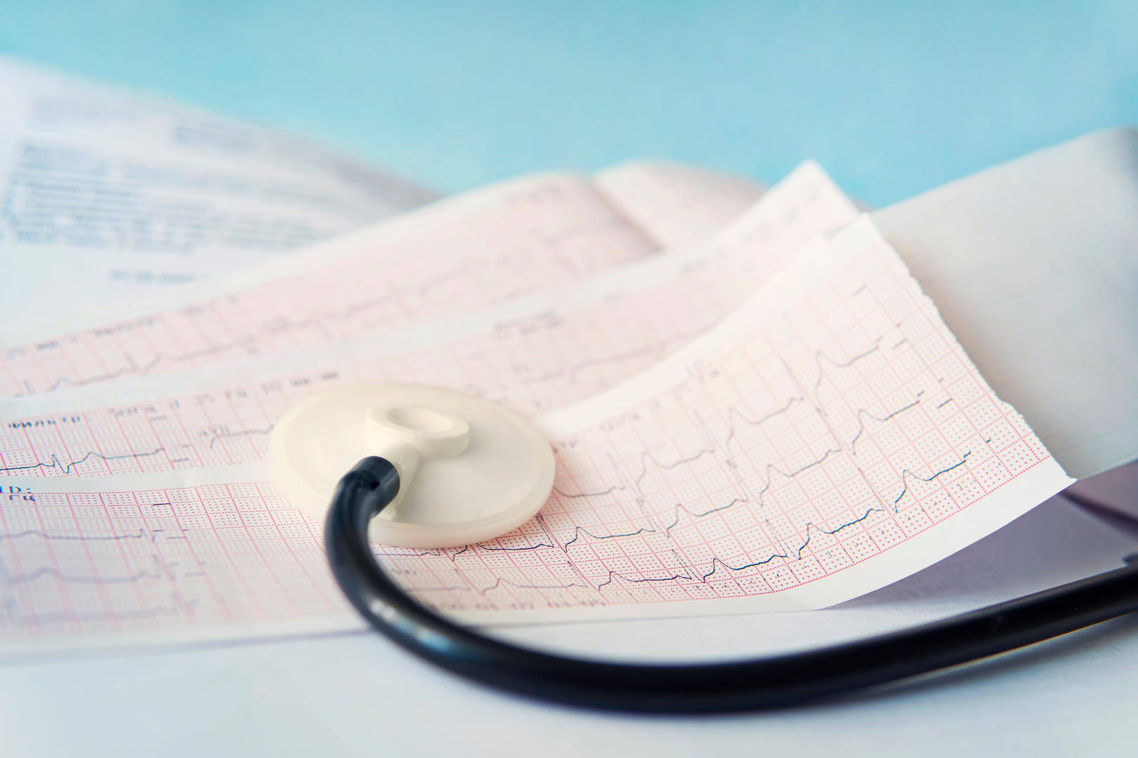 男子上班脑出血昏迷家属选择拔管 人社局不予认定工伤被起诉！法院认定抢救超48小时，驳回